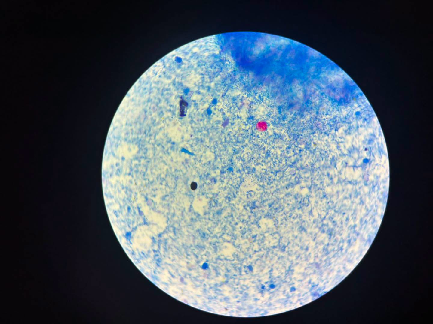 Bacteria en microscopio